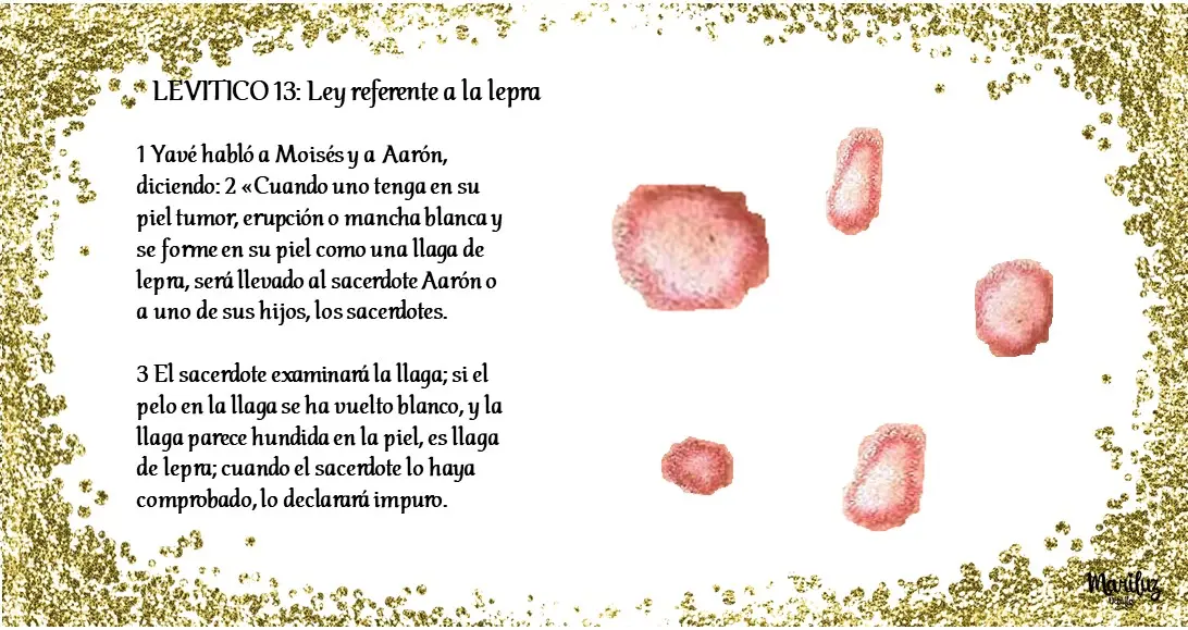 leyes sobre la lepra en la biblia - Qué dijo Jesús de la lepra