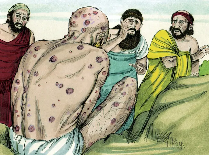 lepra en la biblia - Qué es la lepra en lo espiritual
